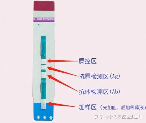 艾滋病第四代检测是抽血吗