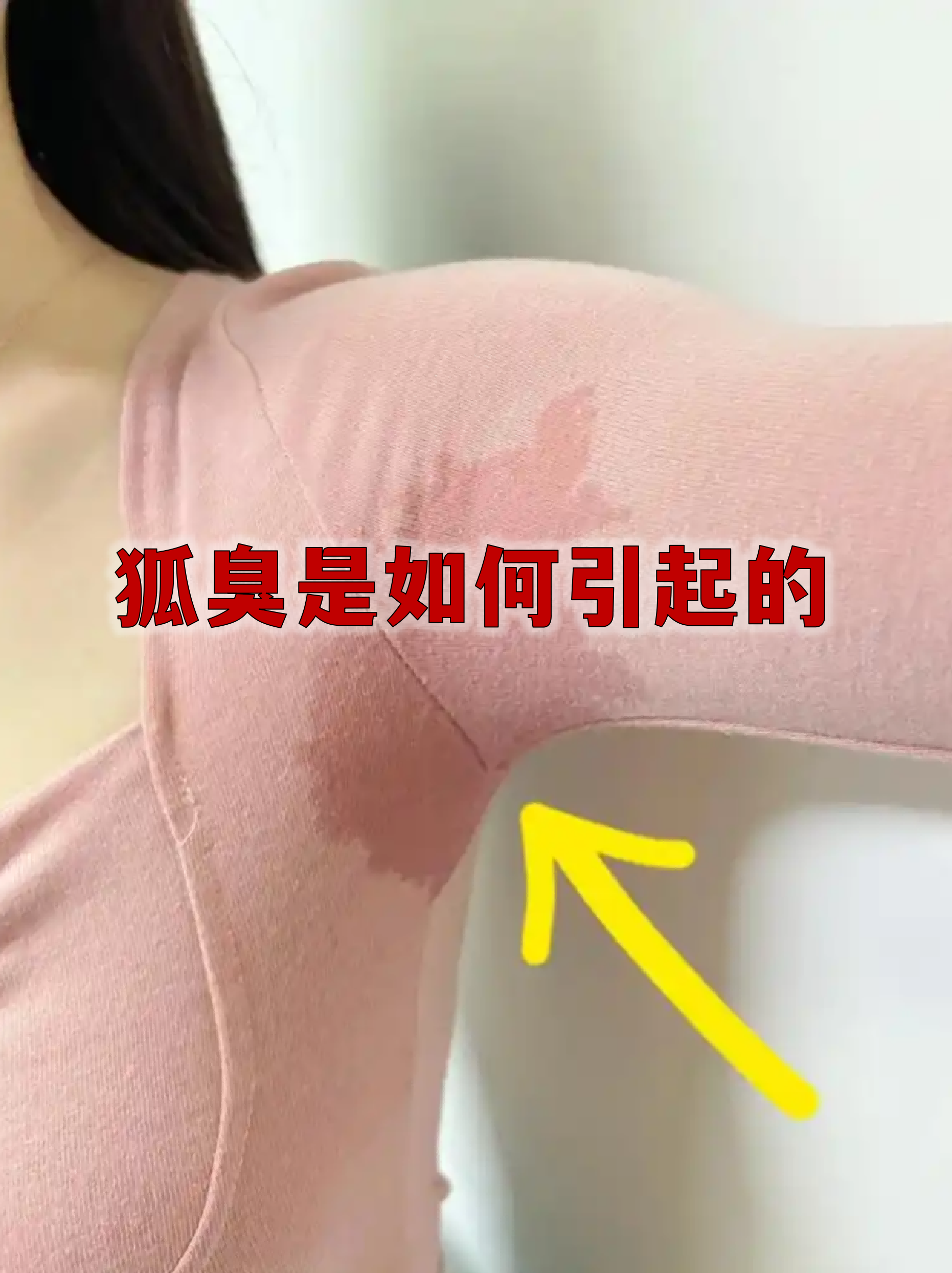 有狐臭的女生是什么原因引起的