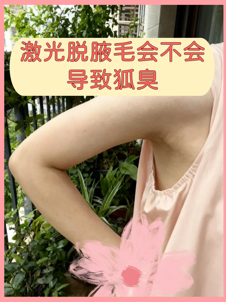 狐臭会自愈吗