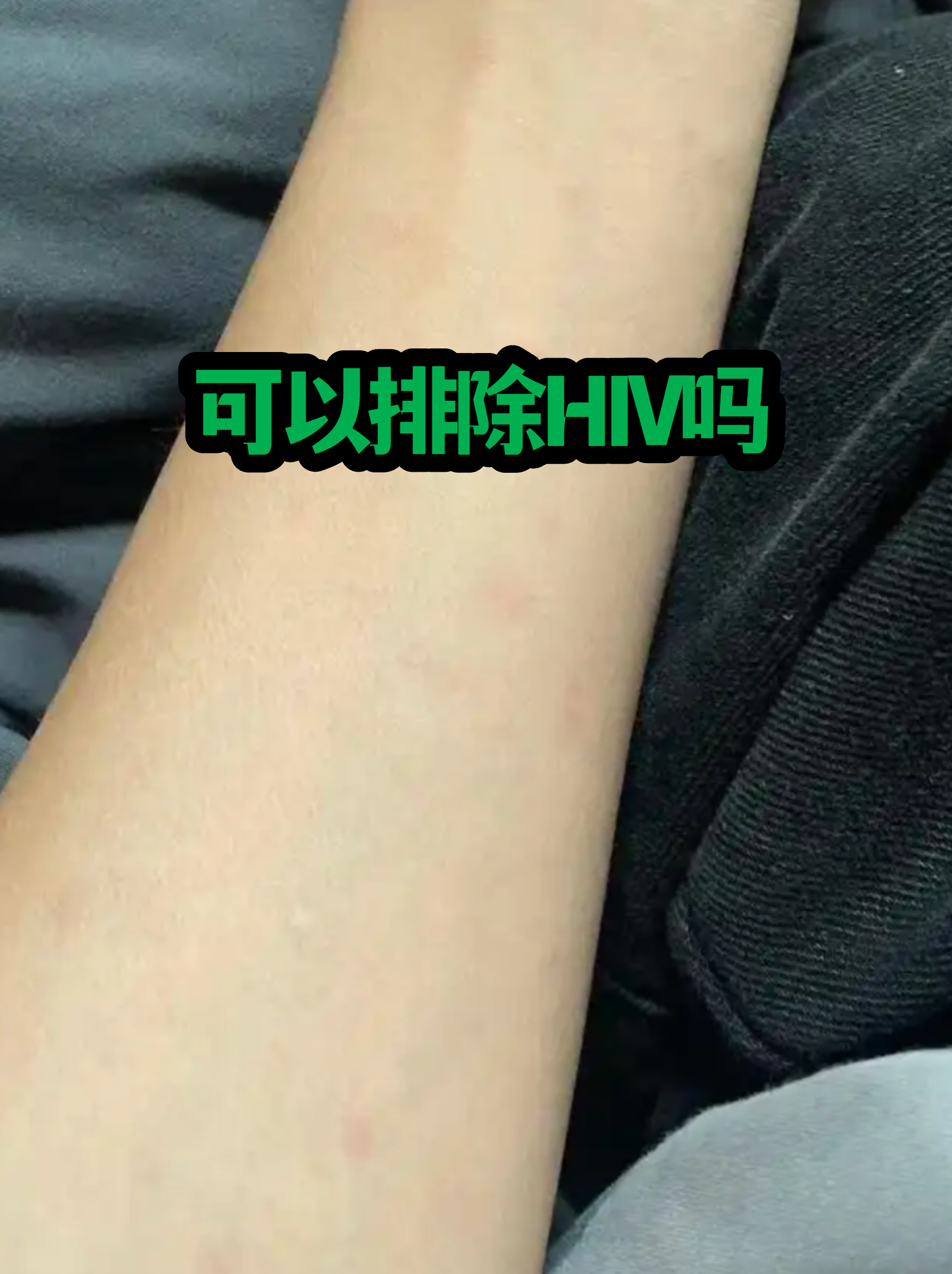 艾滋四代检测多久排除国家标准的简单介绍 艾滋四代检测多久排除国家标准的简单介绍