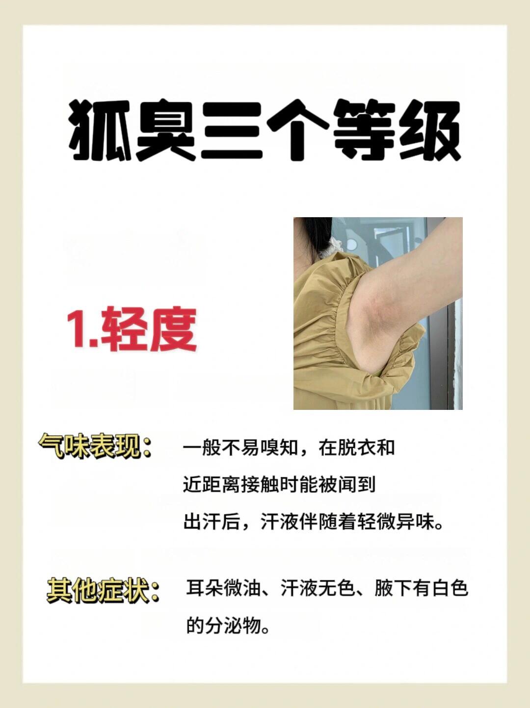 狐臭遗传的能根治吗 狐臭遗传的能根治吗