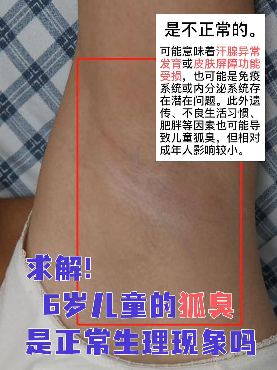腋臭和狐臭有什么区别怎么辨别 腋臭和狐臭有什么区别怎么辨别