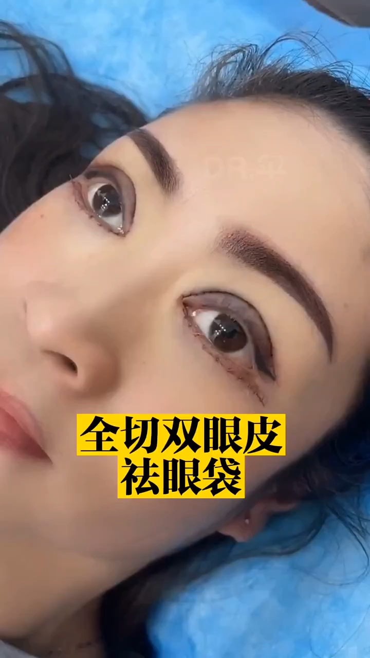 风水学解说割双眼皮 风水学解说割双眼皮