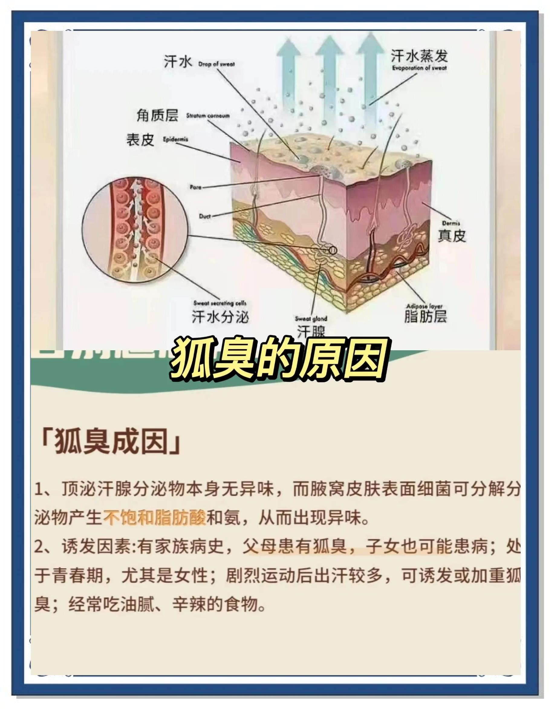 狐臭的人有什么特征 狐臭的人有什么特征