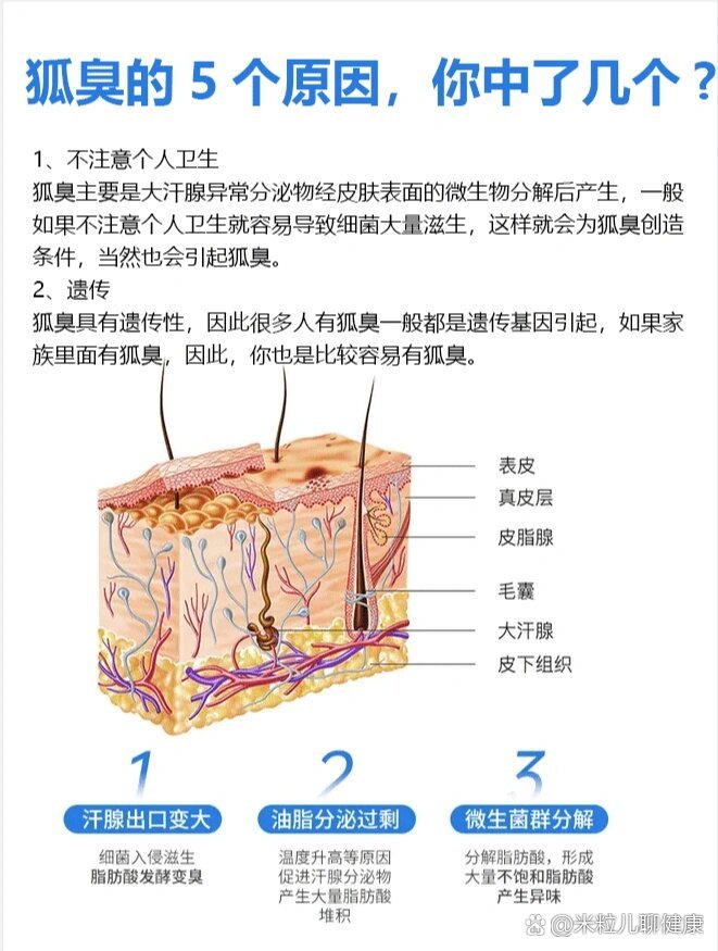 狐臭是咋回事 狐臭是咋回事