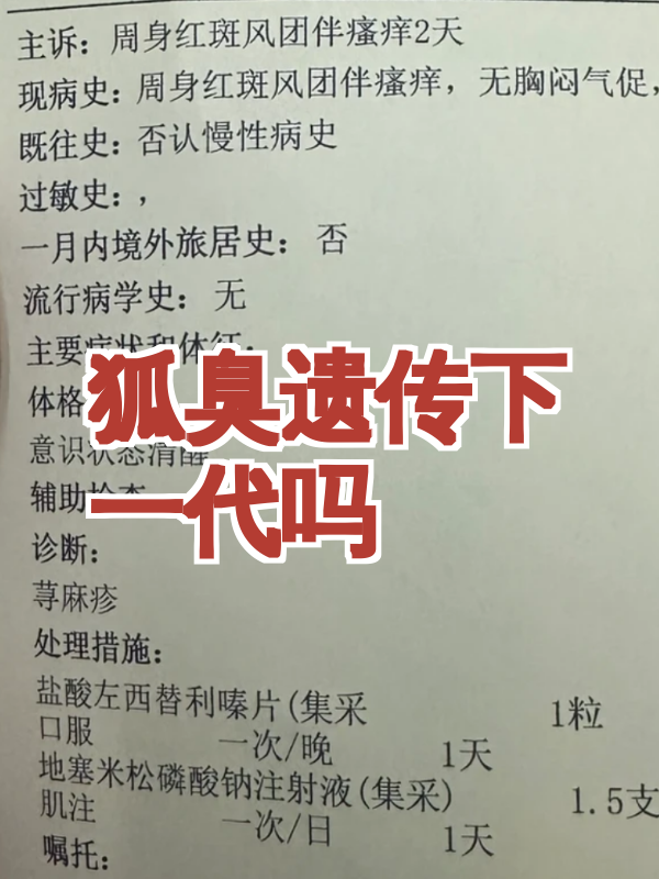狐臭遗传会代代减轻吗