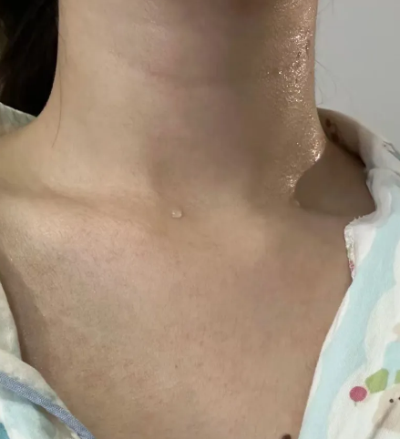 狐臭女孩的一生 狐臭女孩的一生