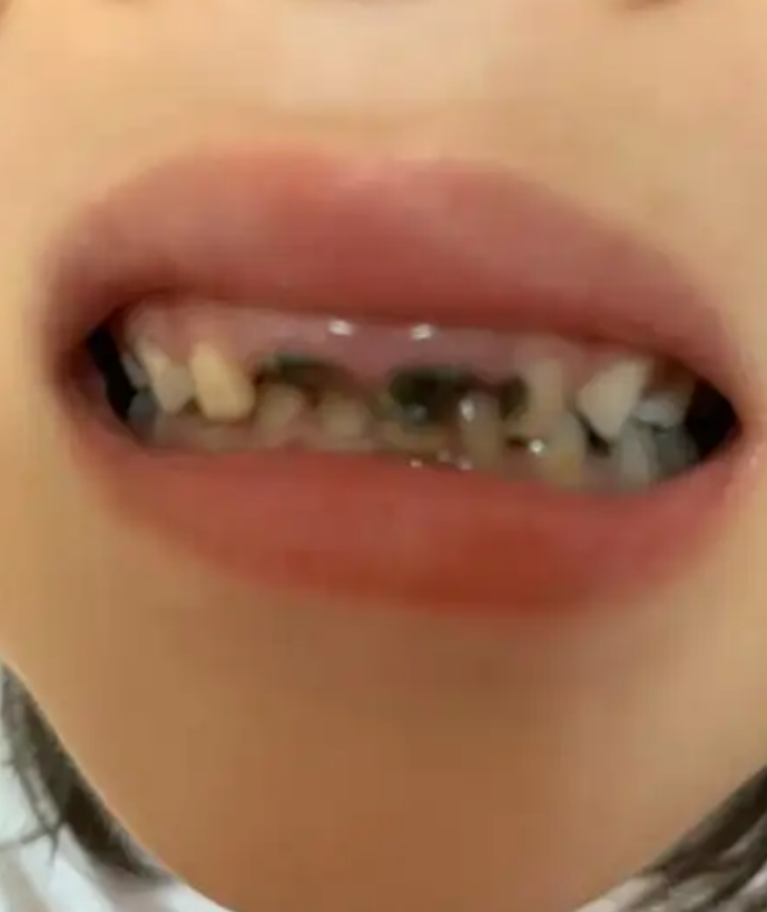 自查解梦掉牙齿 自查解梦掉牙齿
