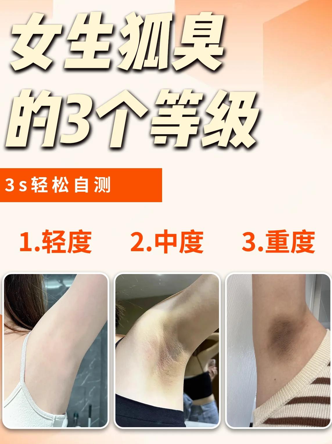 狐臭真的是狐狸臭吗 狐臭真的是狐狸臭吗