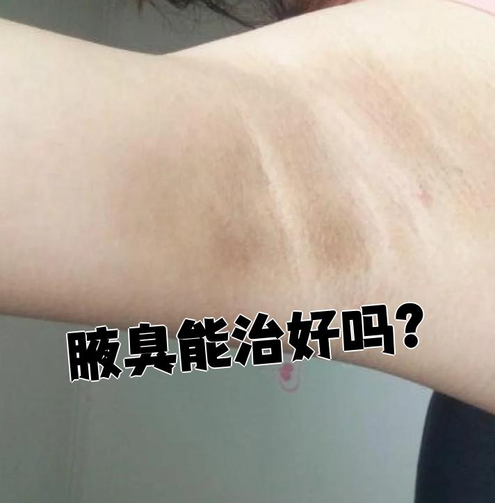 医生一般怎么检查腋臭 医生一般怎么检查腋臭