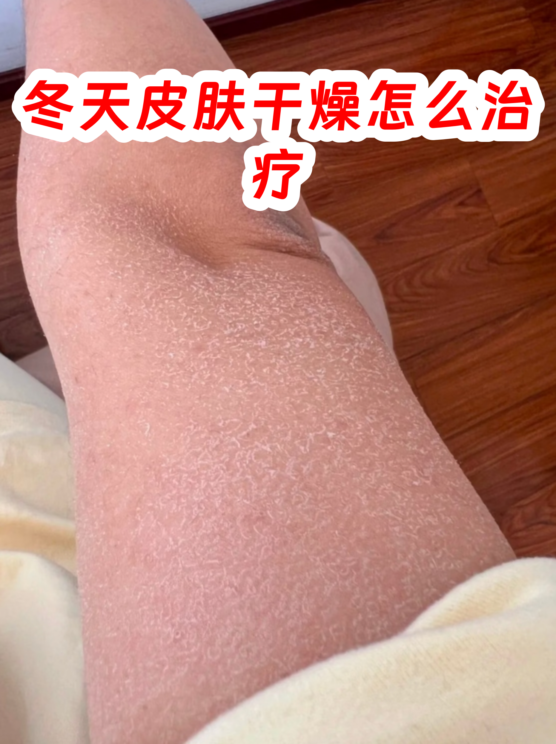 甘油用久了皮肤会变黑吗为什么 甘油用久了皮肤会变黑吗为什么