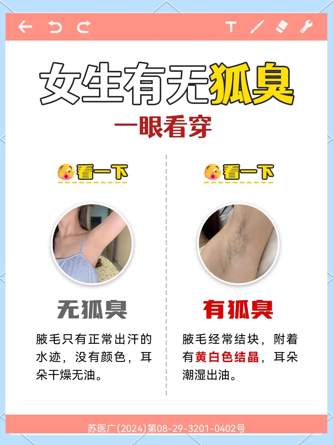后天性狐臭会遗传吗(不是遗传的狐臭会好起来吗)