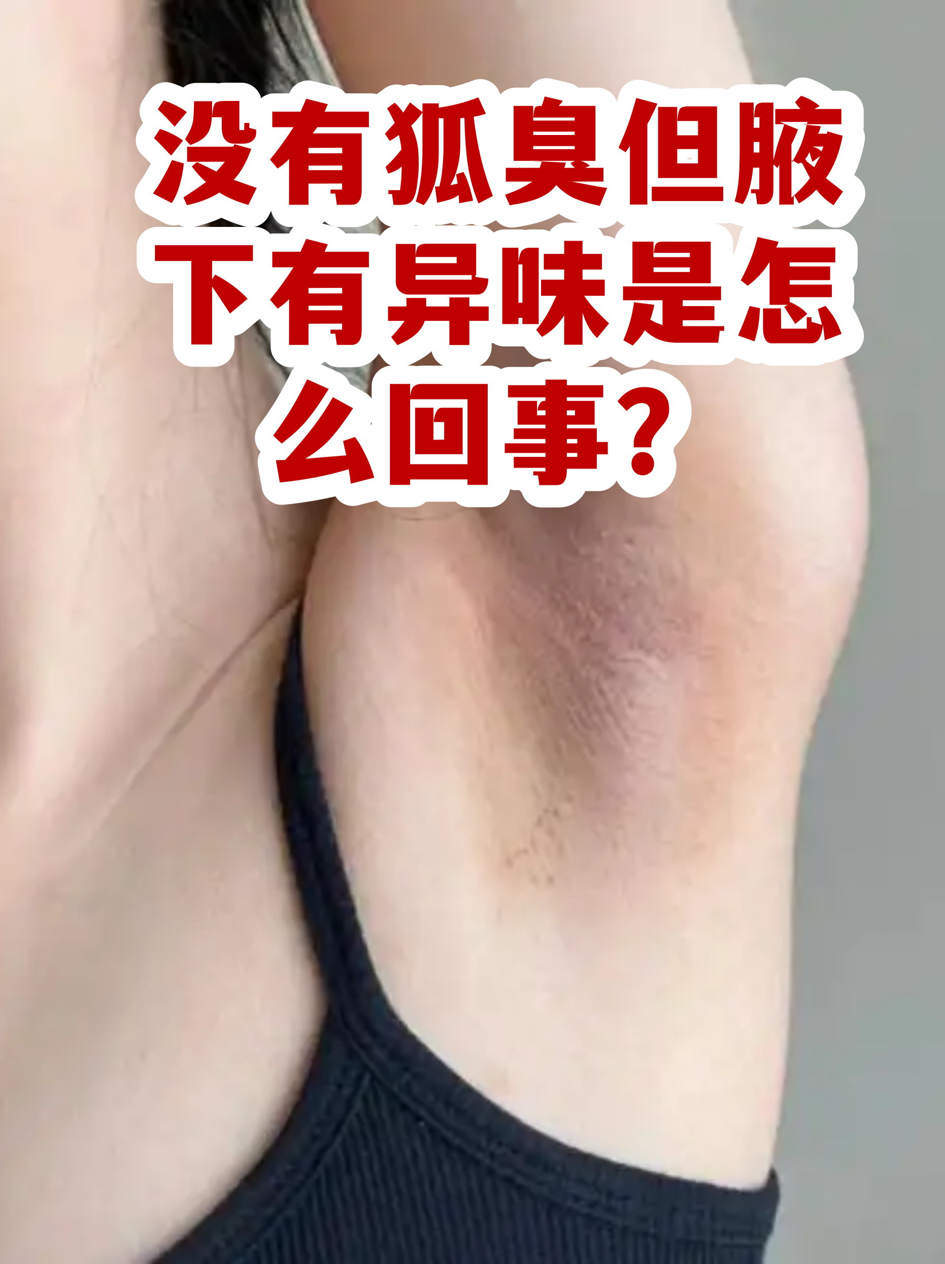狐臭没有遗传会突然出现吗(家里没有狐臭遗传 孩子怎么突然会有) 狐臭没有遗传会突然出现吗(家里没有狐臭遗传 孩子怎么突然会有)