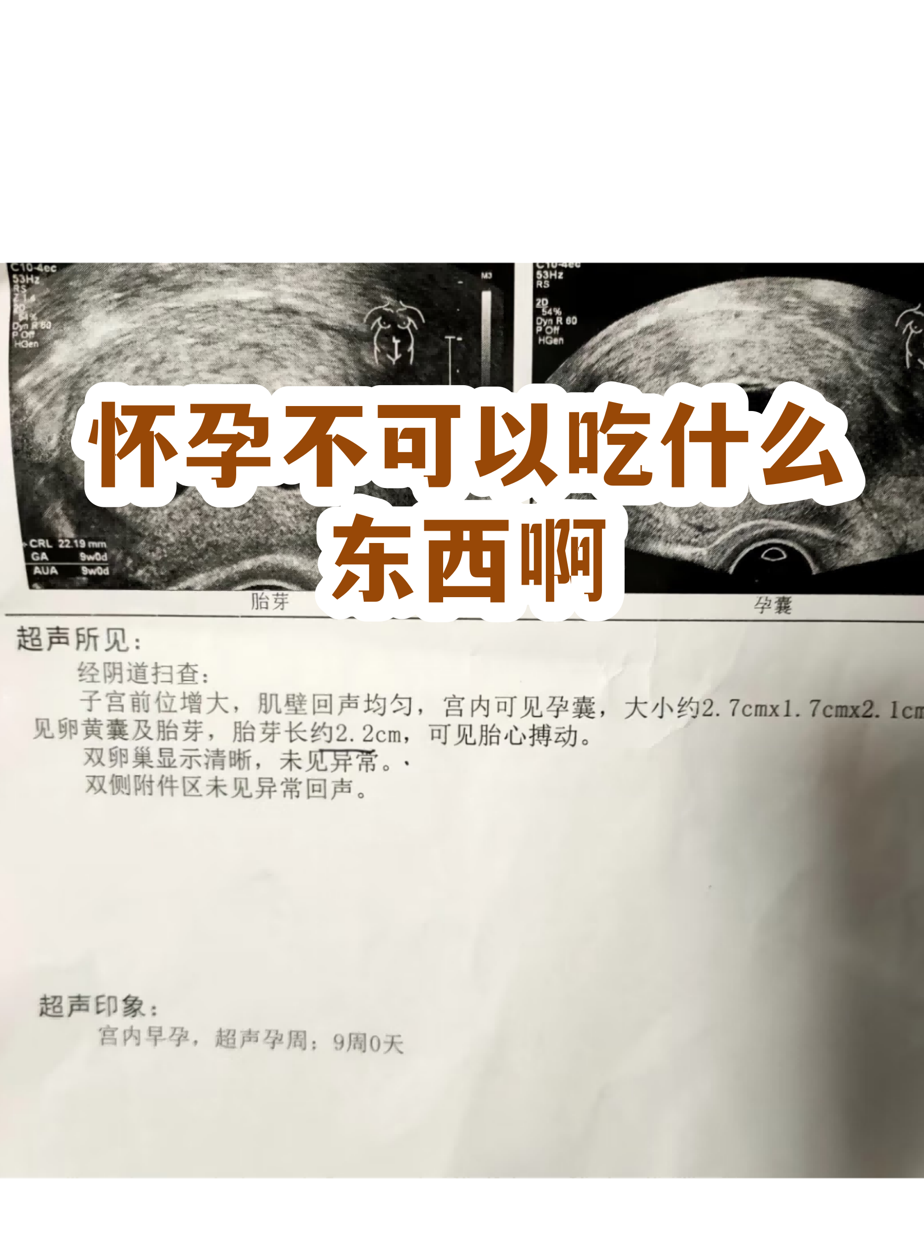 吃什么食物不容易怀孕(吃啥不怀孕还不会伤身体) 吃什么食物不容易怀孕(吃啥不怀孕还不会伤身体)