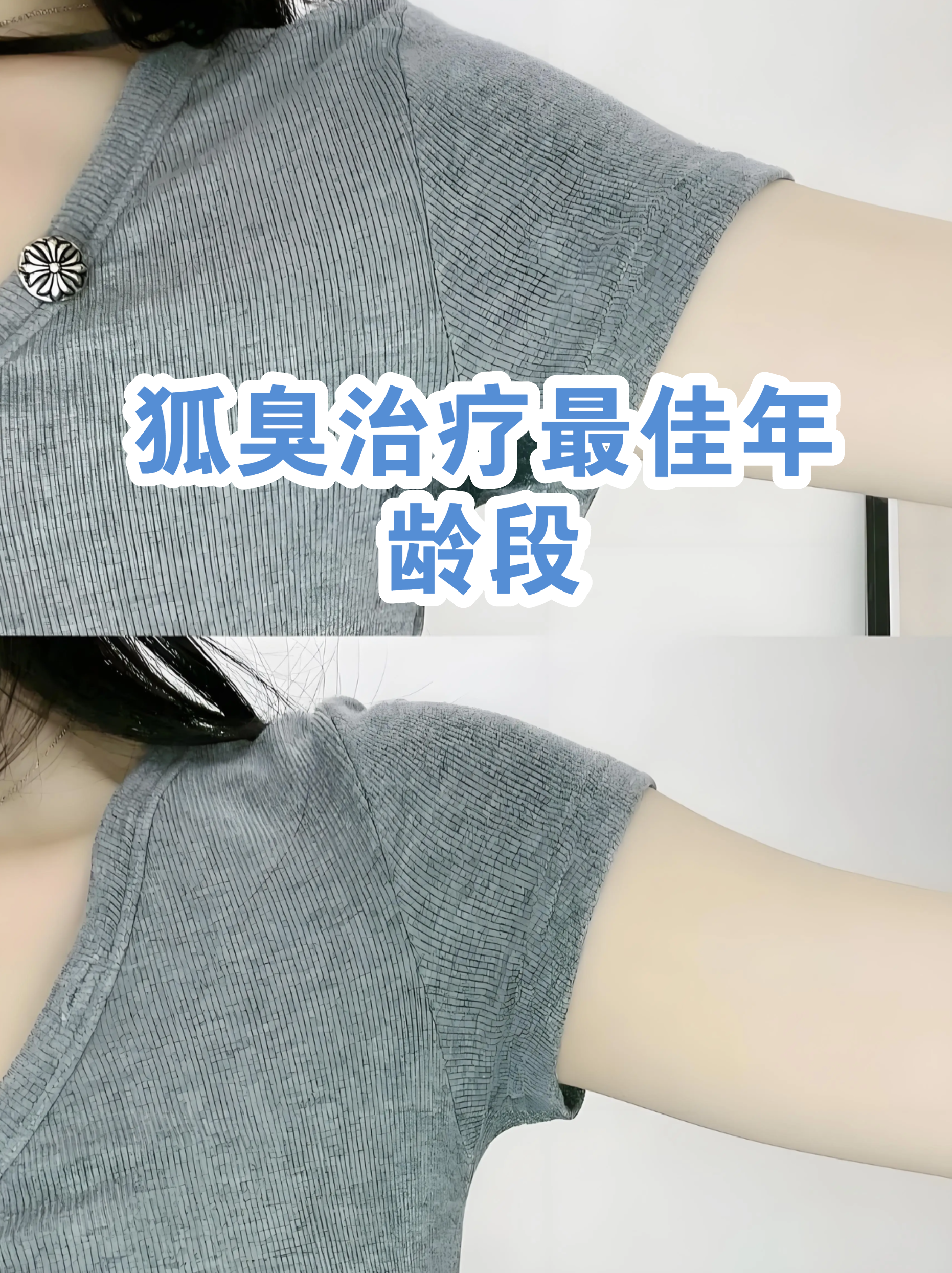 儿童做狐臭手术的最佳年龄(儿童狐臭手术最佳年龄做微创)