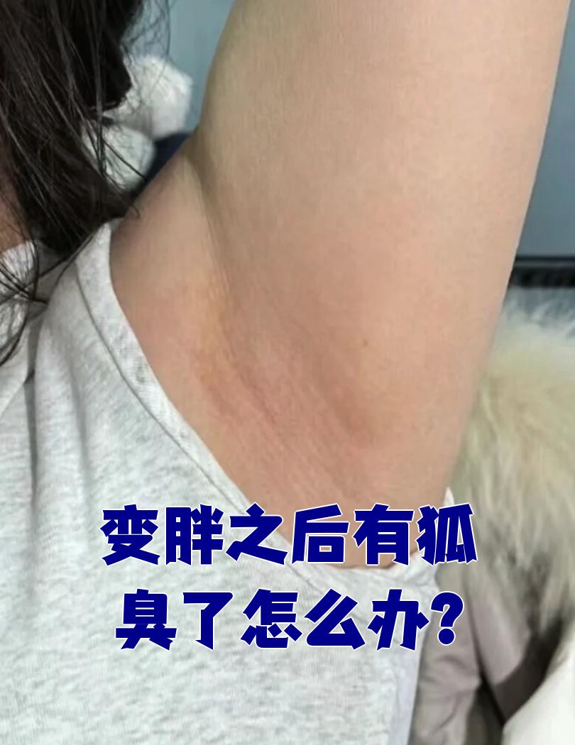 狐臭的腋下图片(狐臭是怎么形成的腋下有味) 狐臭的腋下图片(狐臭是怎么形成的腋下有味)