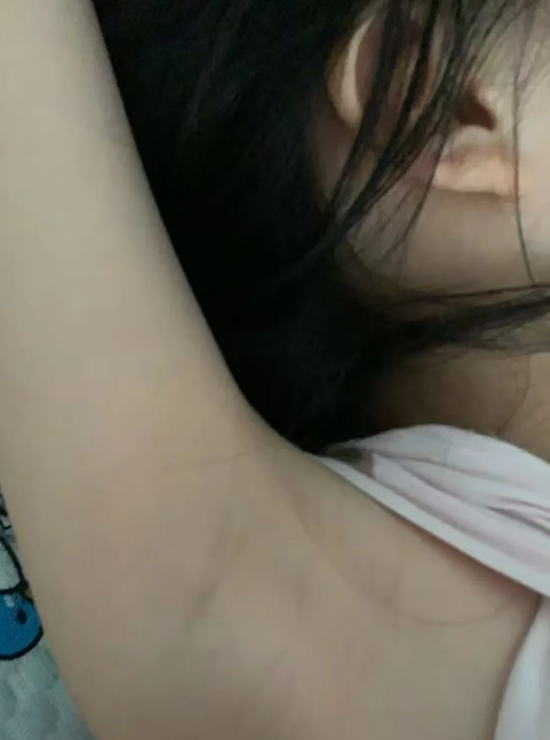 青春期假性狐臭多久会消失的简单介绍 青春期假性狐臭多久会消失的简单介绍