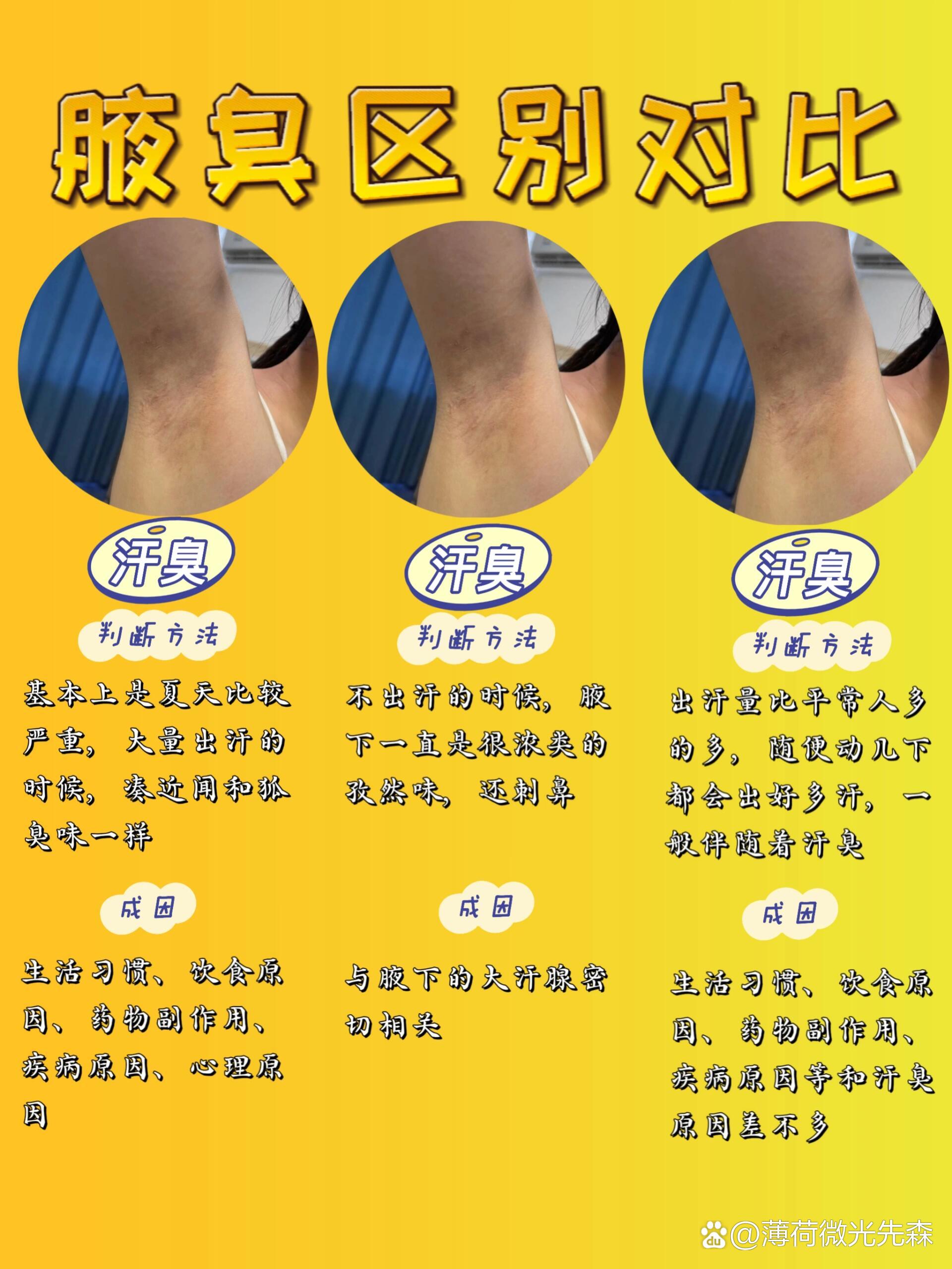 狐臭重的女人说明什么(狐臭重的女人说明什么性格) 狐臭重的女人说明什么(狐臭重的女人说明什么性格)