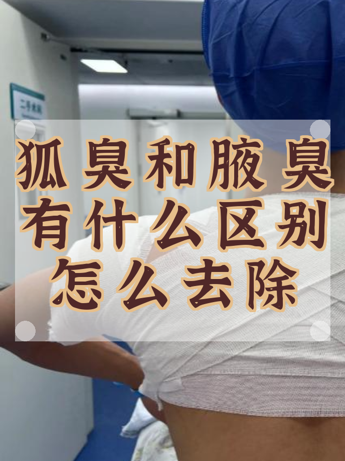 有狐臭代表什么(有狐臭要注意什么)