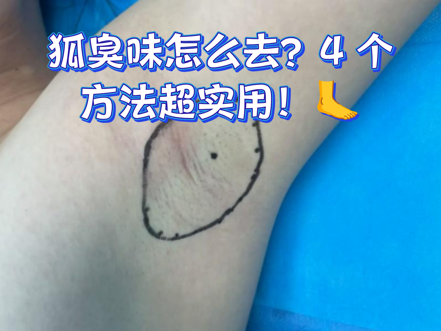 怎么去除狐臭小妙招(怎么去除狐臭永久简单的方法)
