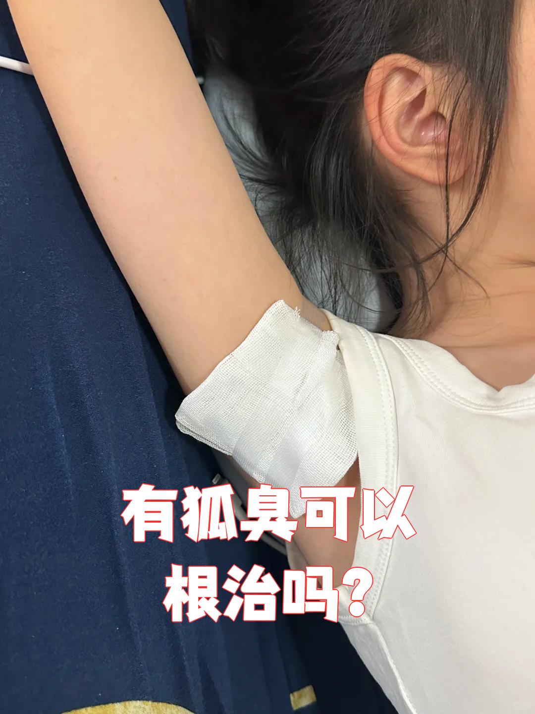 有狐臭的女生可以结婚吗(有狐臭的女生可以结婚吗知乎)