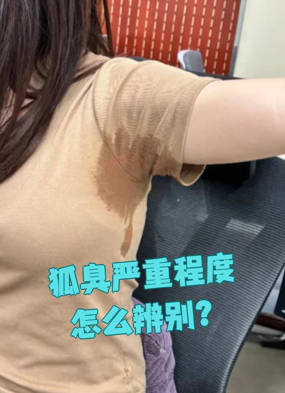 狐臭的女生有什么特征(狐臭的女生有什么特征图片)