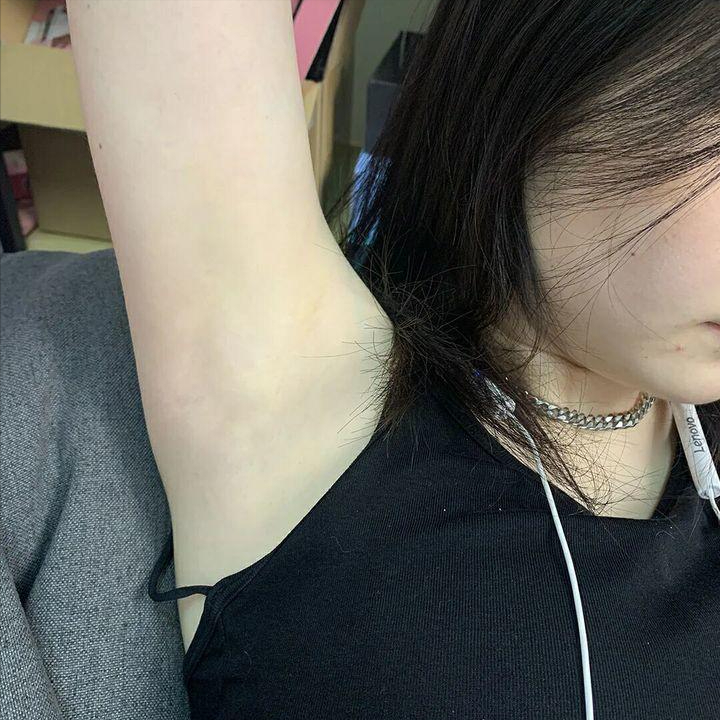 狐臭的女生有什么特征(狐臭的女生有什么特征图片) 狐臭的女生有什么特征(狐臭的女生有什么特征图片)