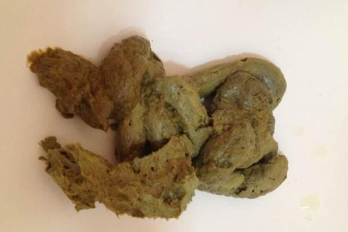 梦见拉屎预兆解析(梦见拉屎的预兆解析) 梦见拉屎预兆解析(梦见拉屎的预兆解析)