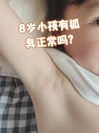 有狐臭的人有福气吗图片(有狐臭的人是命运不好吗为什么)