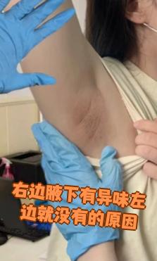 有狐臭的人有福气吗图片(有狐臭的人是命运不好吗为什么)