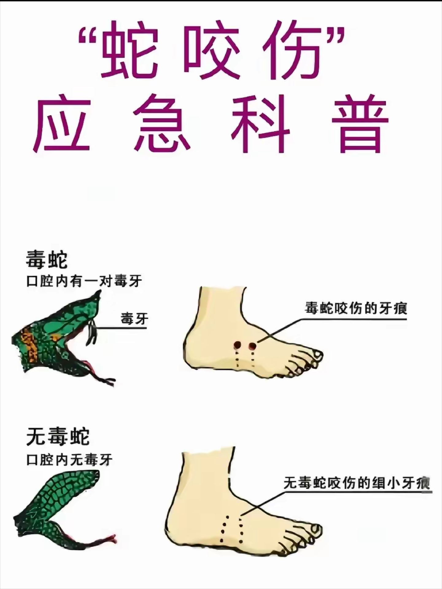 梦见蛇咬自己什么意思(做梦自己被蛇咬了是什么预兆) 梦见蛇咬自己什么意思(做梦自己被蛇咬了是什么预兆)