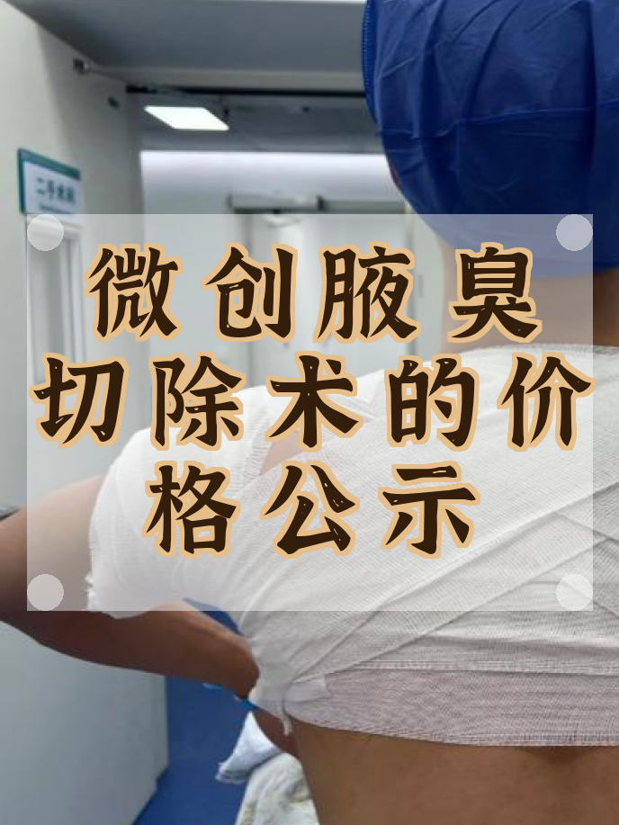 狐臭手术费能报销吗(狐臭手术费需要住院吗) 狐臭手术费能报销吗(狐臭手术费需要住院吗)