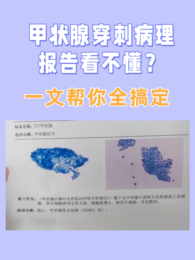 罗家风水大师哪里看甲状腺好的简单介绍