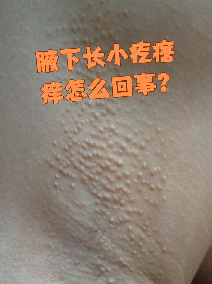 青春期假性狐臭特征(青春期假性狐臭特征图片)