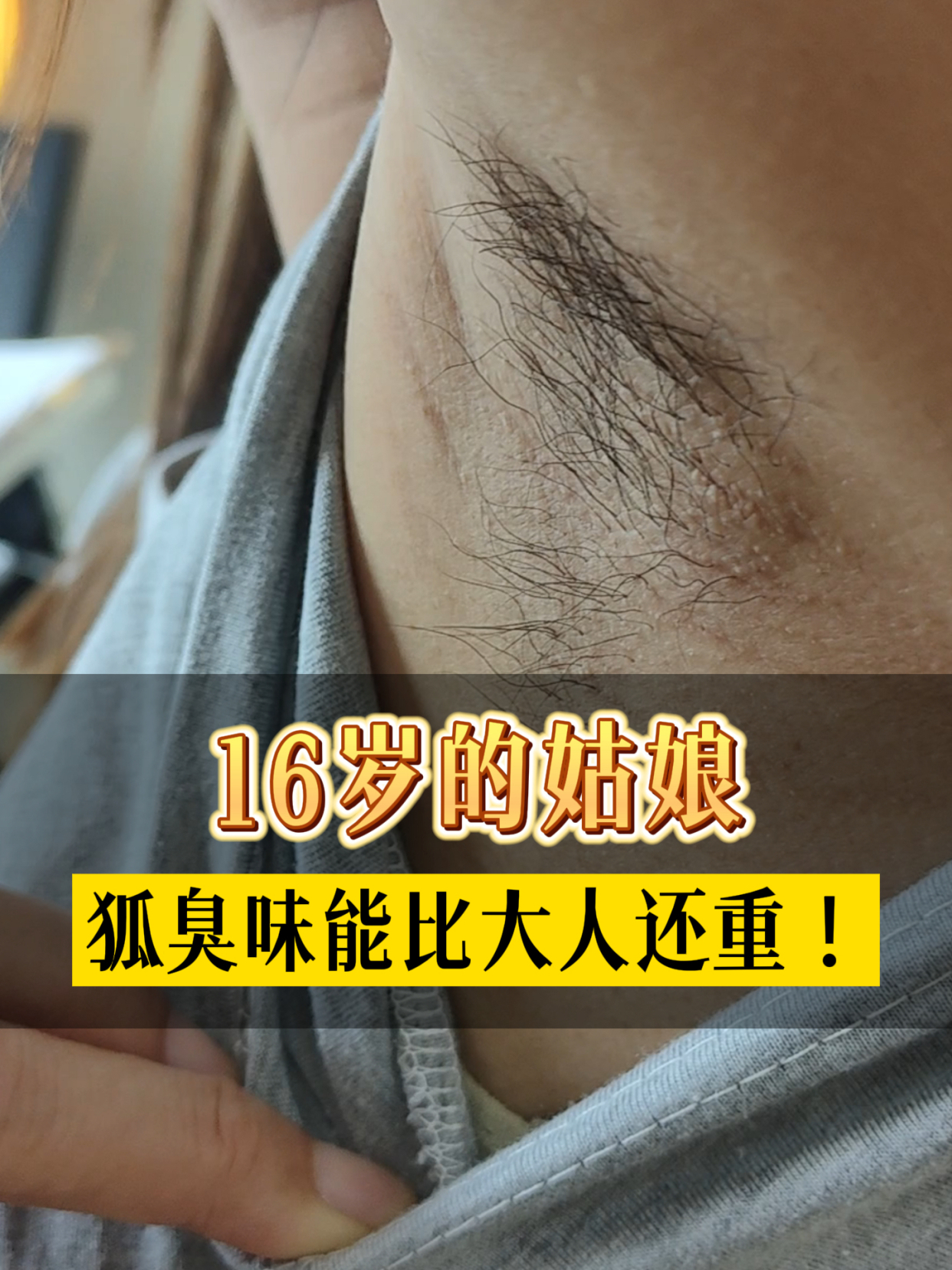青春期假性狐臭特征(青春期假性狐臭特征图片)