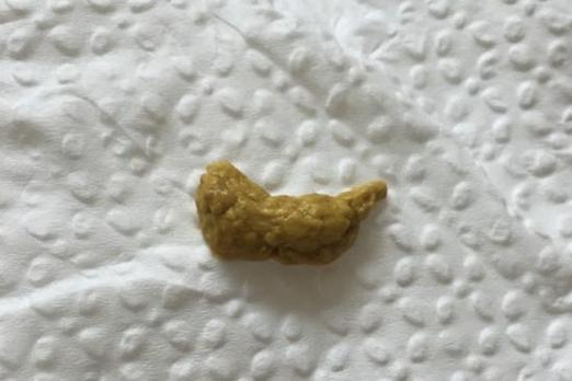 做梦梦见拉了屎(做梦梦见拉屎在被窝里什么意思)