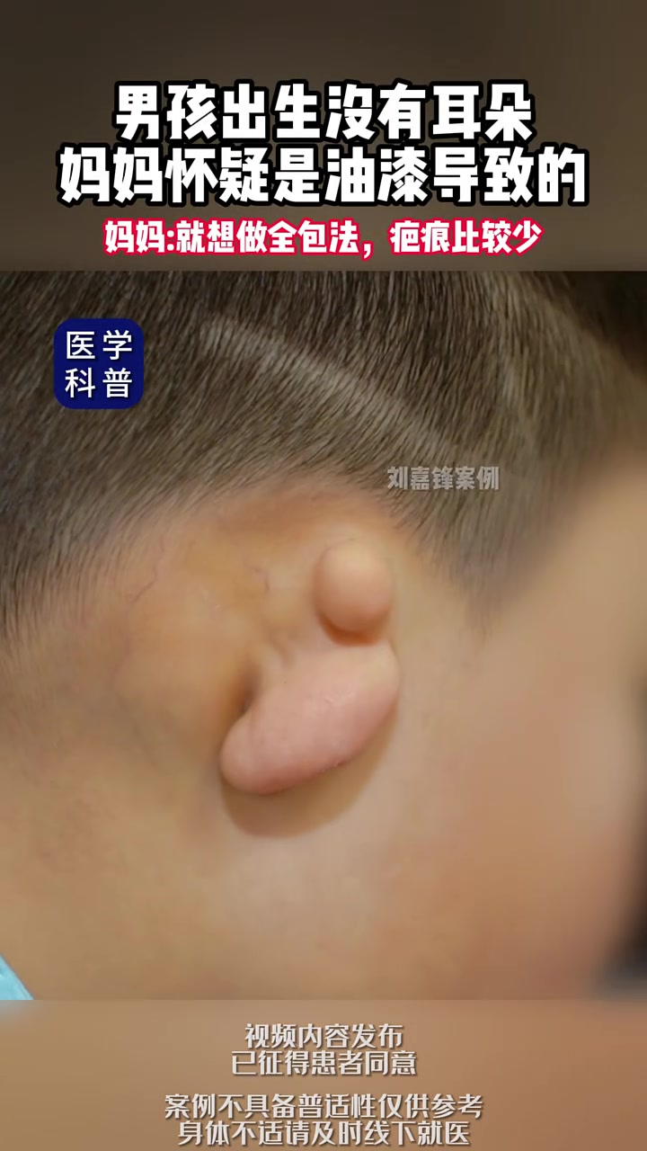 包含儿子从小油耳朵好怕有狐臭啊的词条