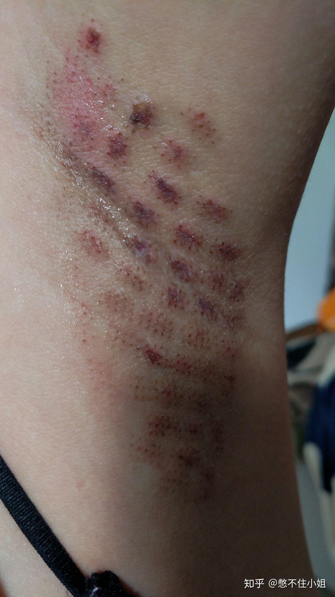 有狐臭的人命苦吗知乎(狐臭的人知道自己狐臭吗)