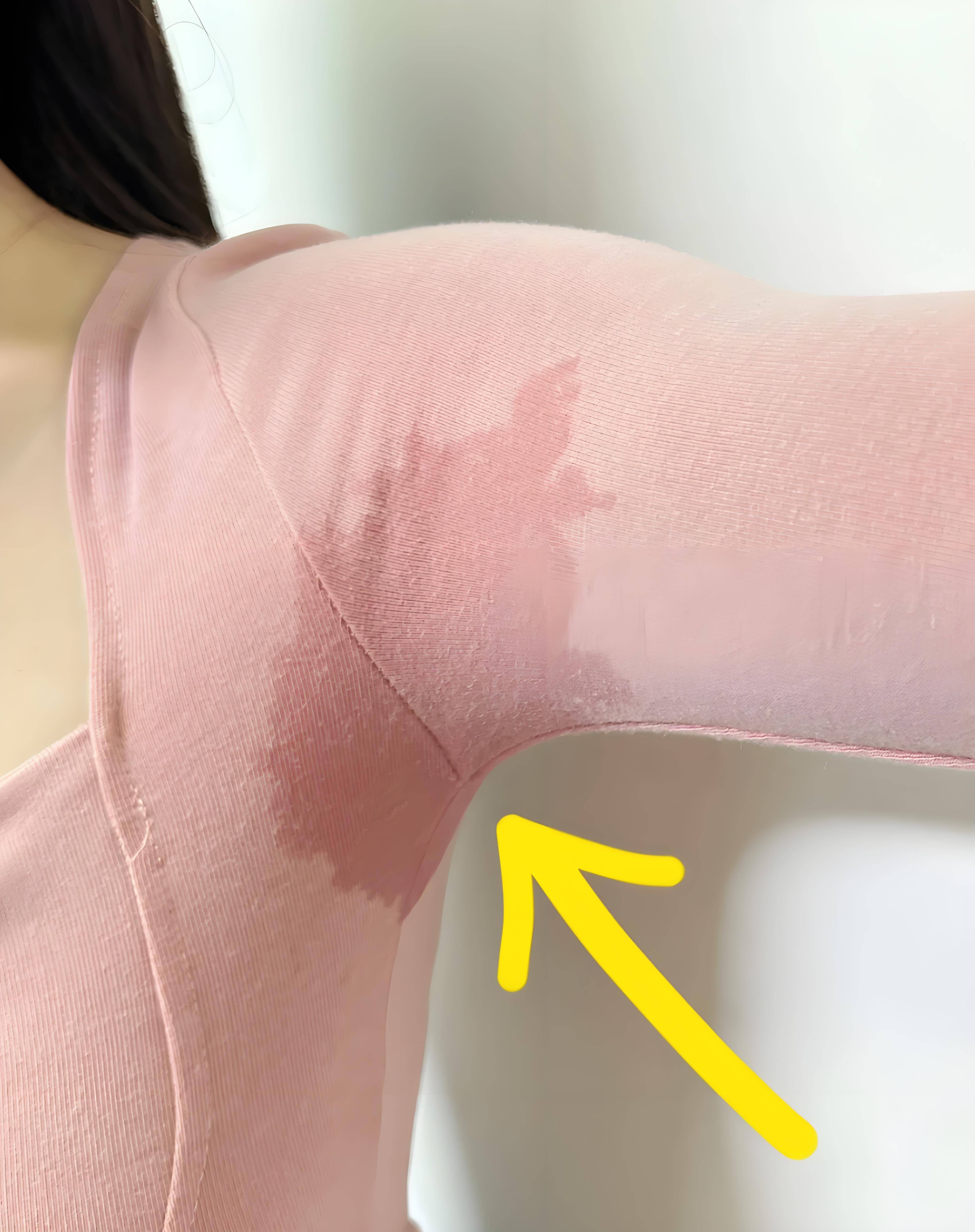 腋下有狐臭怎么去除(腋下有狐臭怎么去除小妙招)