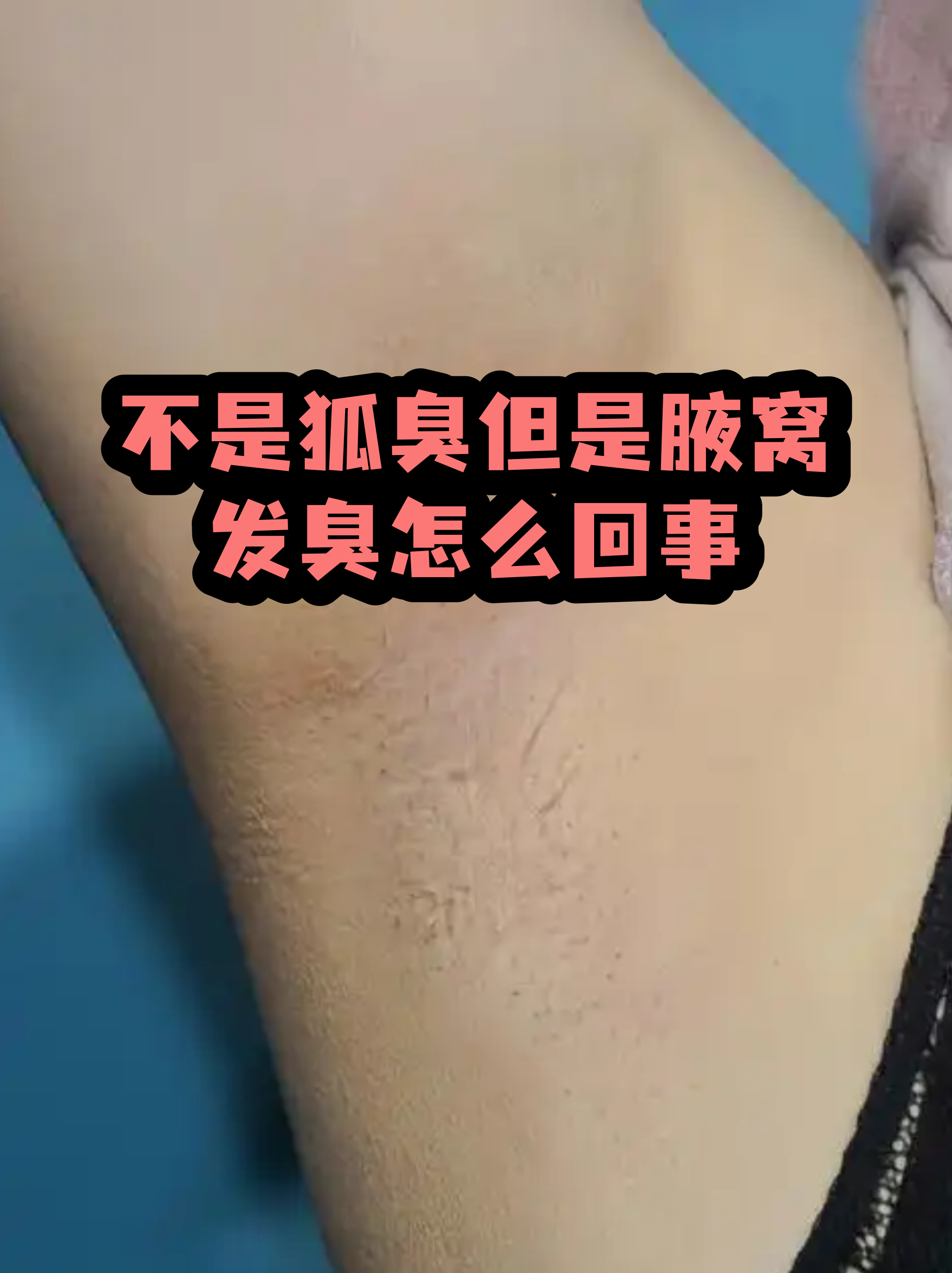 狐臭与正常腋窝图(狐臭的腋窝毛囊炎图片)