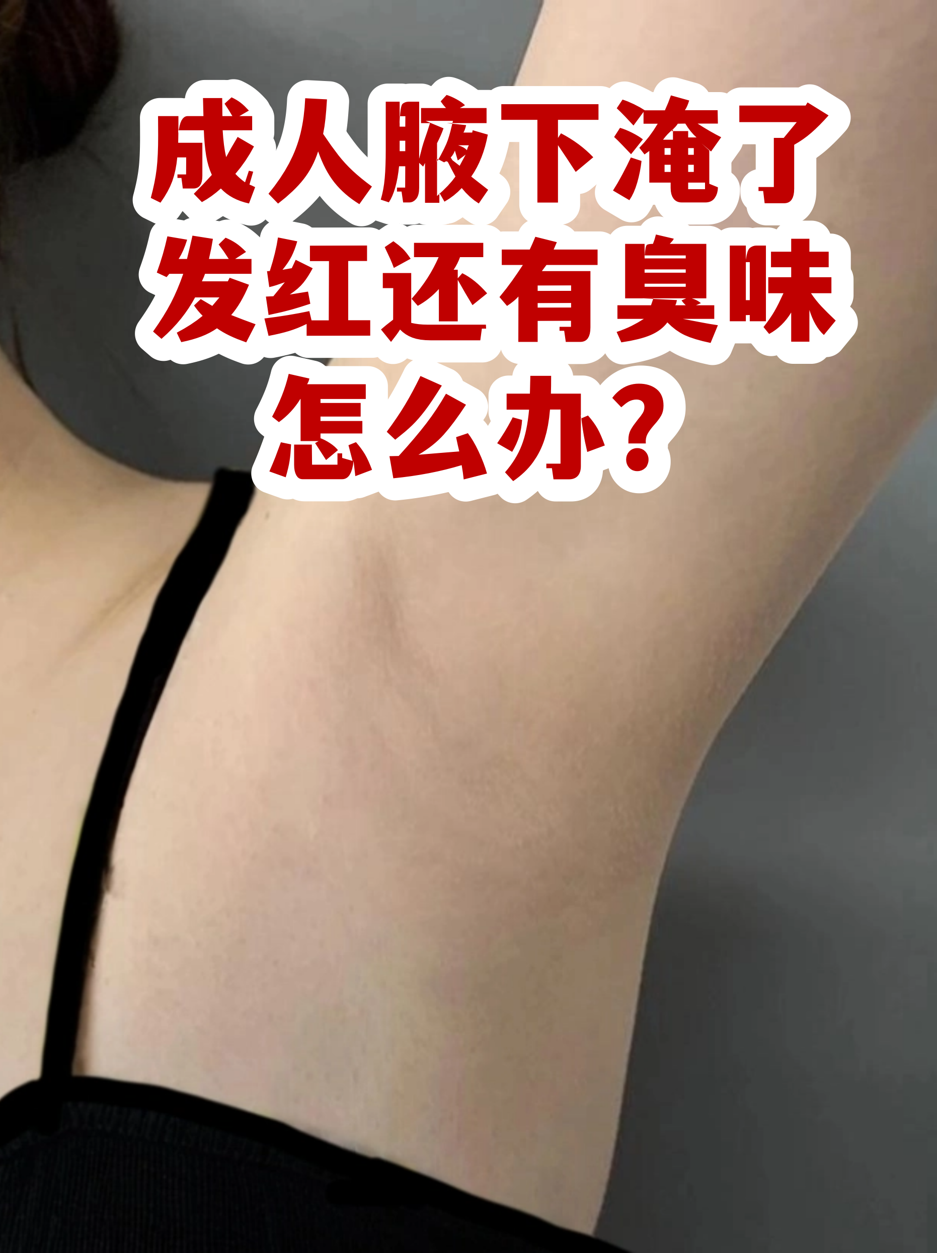 油耳型腋下异味怎么根治中成药的简单介绍