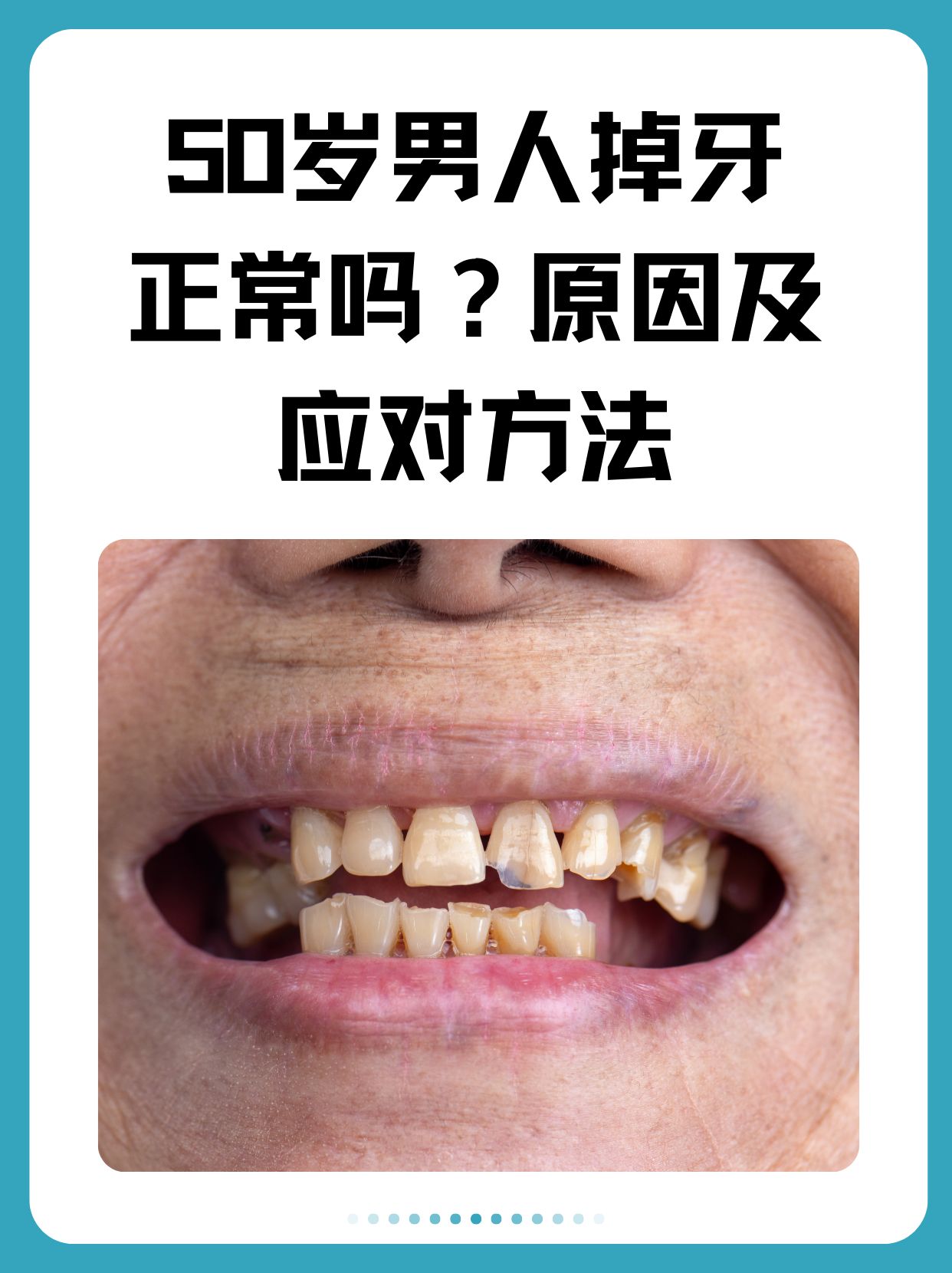 周公解梦梦见掉牙是怎么回事(周公解梦梦见掉牙是怎么回事视频)