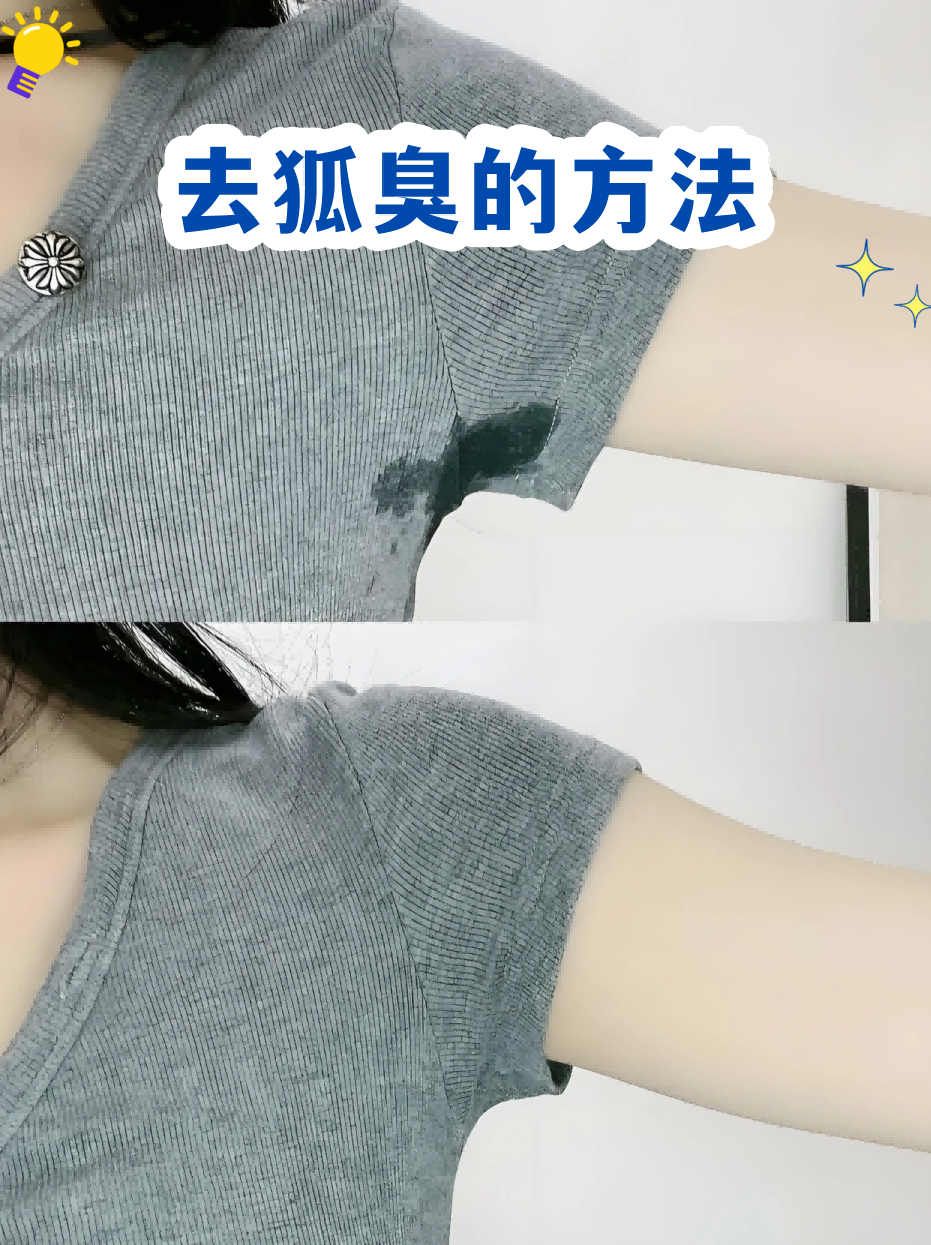 狐臭可以去当兵吗(狐臭也不能去当兵吗) 狐臭可以去当兵吗(狐臭也不能去当兵吗)