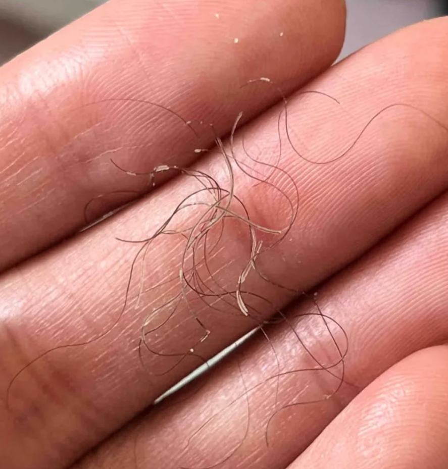 狐臭有没有可能自己好(狐臭有没有可能不是遗传的)