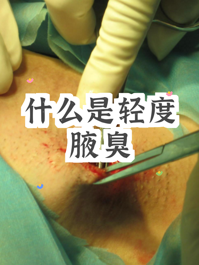 狐臭女孩子几岁可以闻到(狐臭女孩子几岁可以闻到味道)