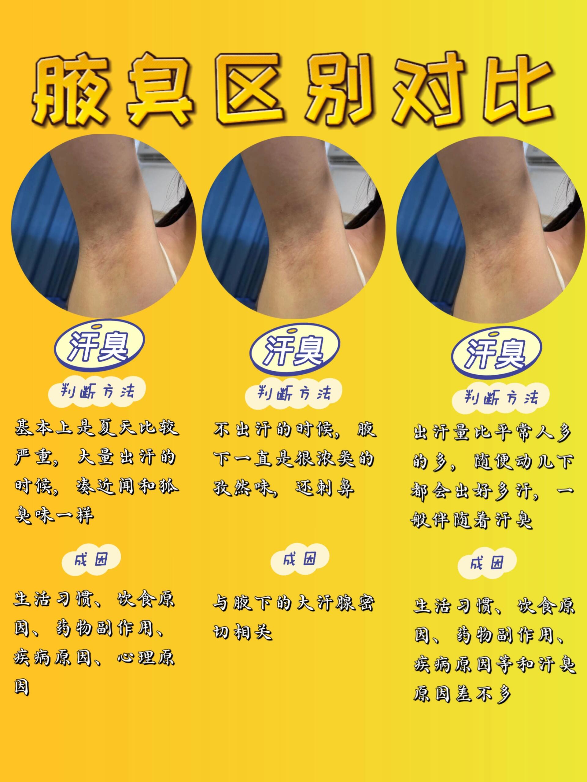 狐臭会后来产生的吗(狐臭会后来产生的吗女性)
