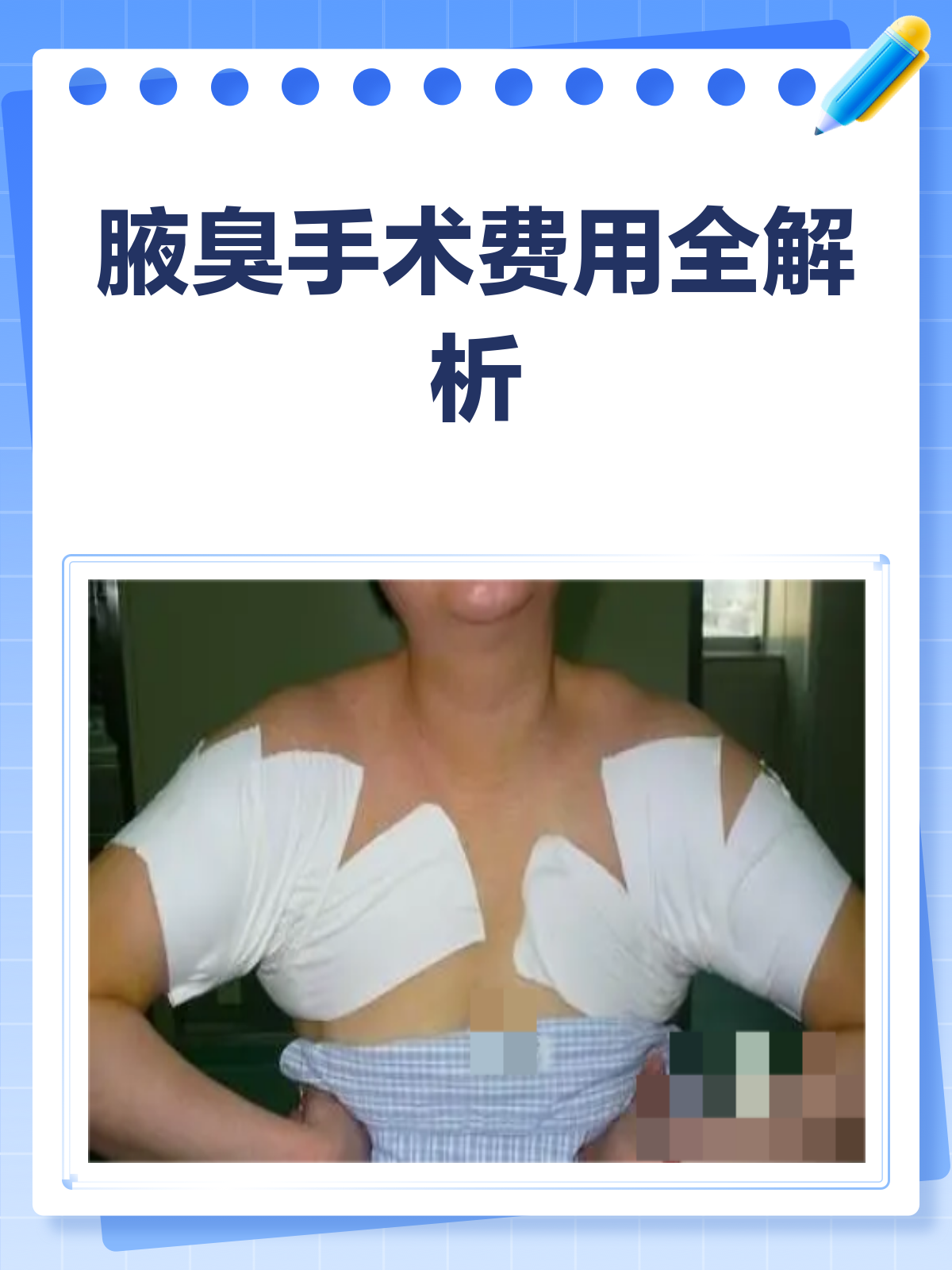 哈尔滨狐臭手术多少钱(割狐臭需要多少钱的手术费哈尔滨松北区) 哈尔滨狐臭手术多少钱(割狐臭需要多少钱的手术费哈尔滨松北区)