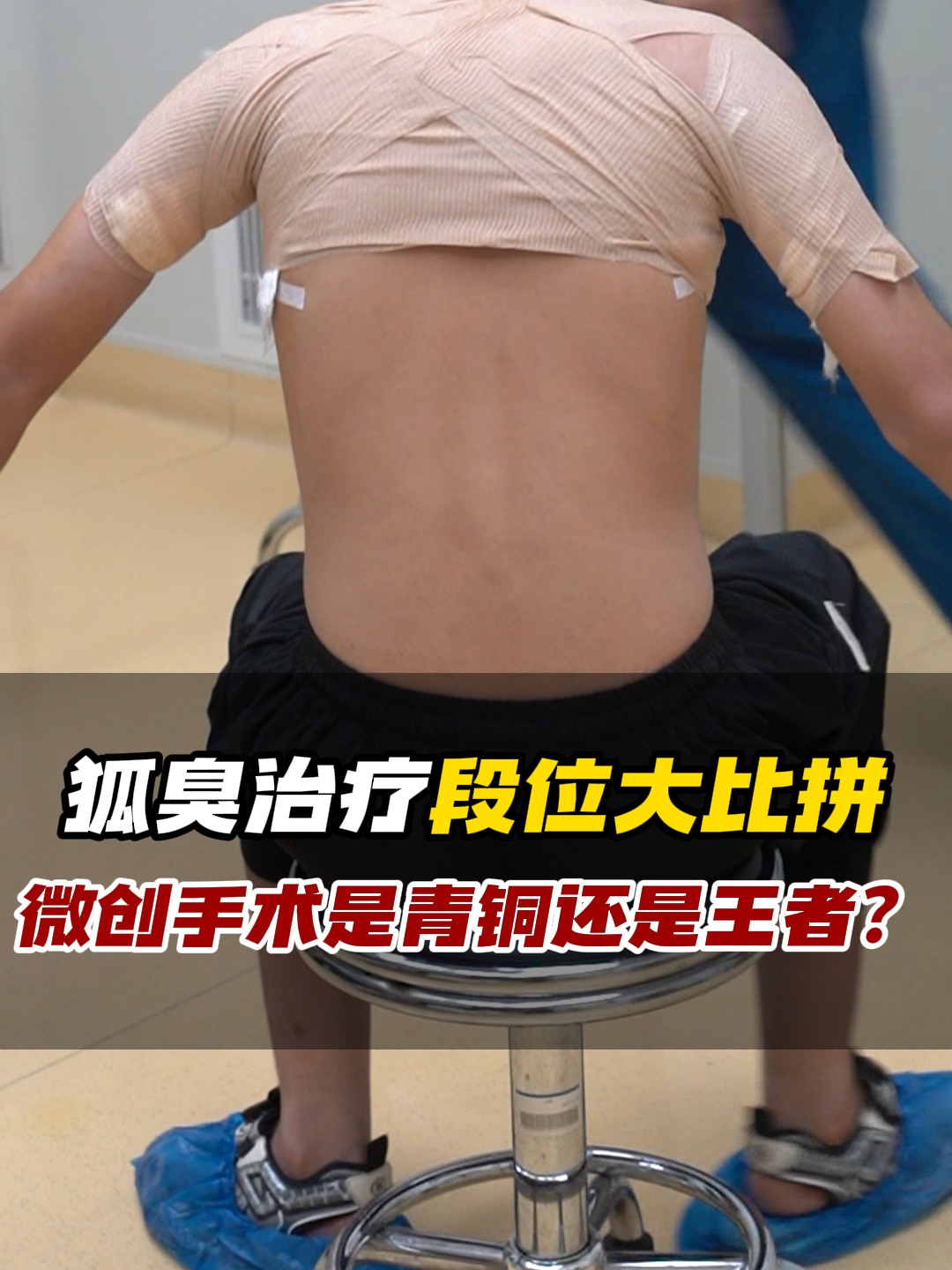 农安狐臭手术(做狐臭手术农村合作医疗可以报销吗)