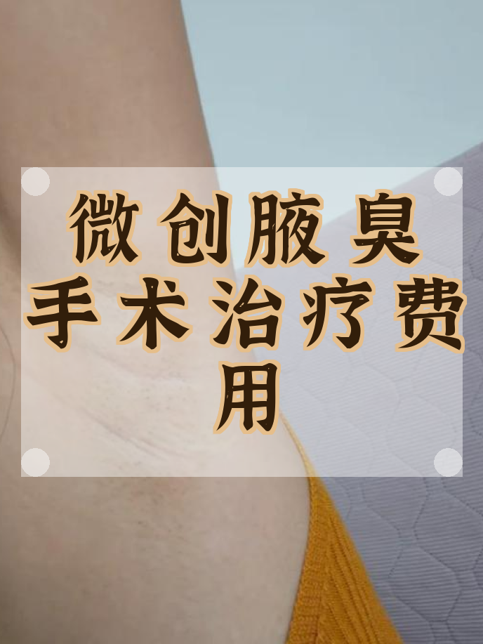 狐臭手术费用贵吗(狐臭手术费用贵吗多少钱) 狐臭手术费用贵吗(狐臭手术费用贵吗多少钱)