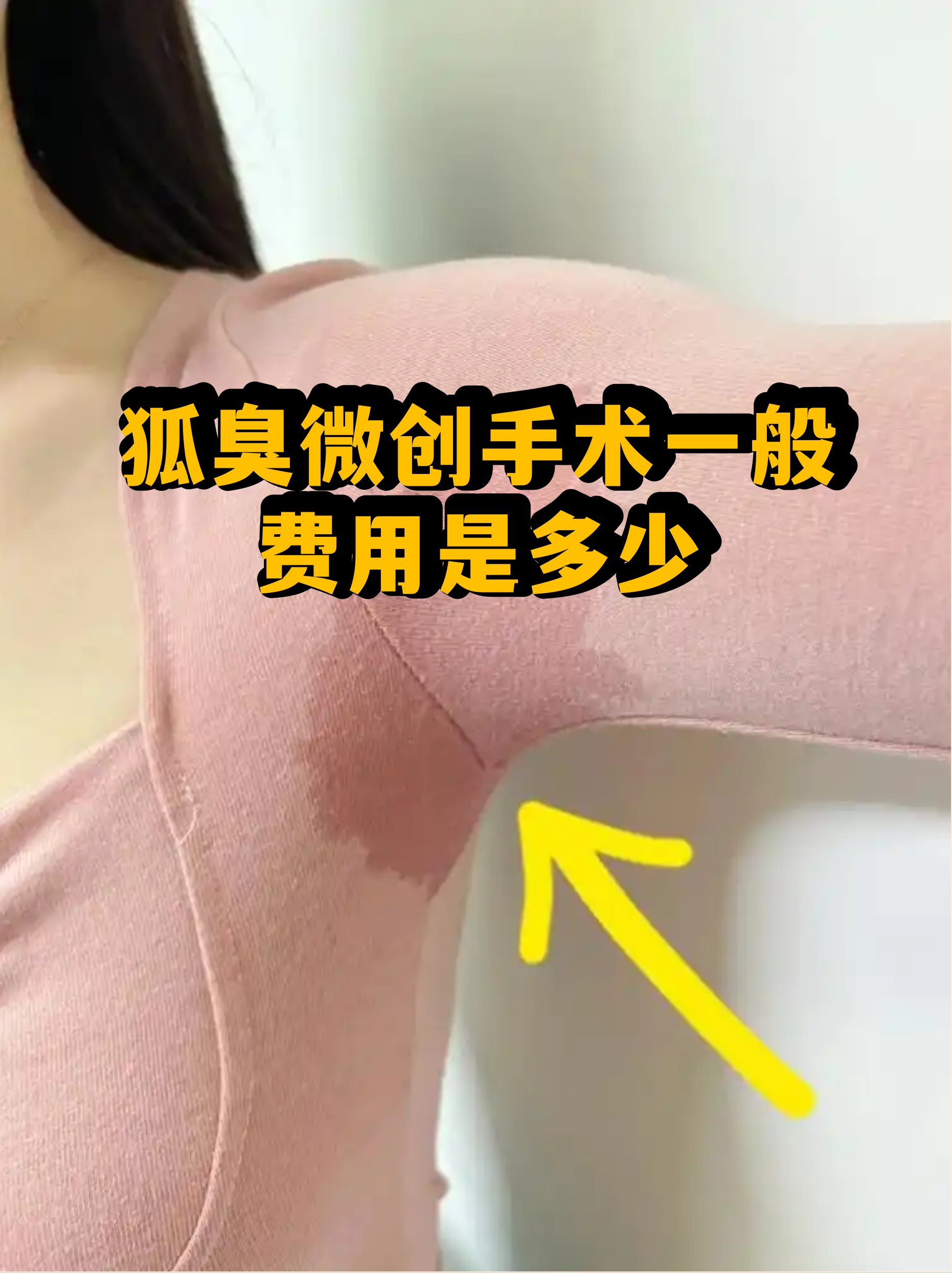狐臭手术一般费用多少可以报销吗(狐臭手术一般费用多少可以报销吗?)